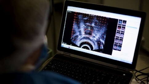 Milano, lotta ai tumori: scoperto il gene che "spegne" il cancro Milano, lotta ai tumori: scoperto il gene che "spegne" il cancro