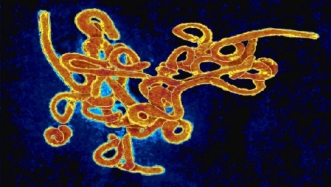 Il vaccino per sconfiggere il virus Ebola si prepara in Italia Il vaccino per sconfiggere il virus Ebola si prepara in Italia