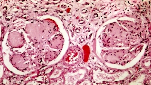 L'insulina? Ora si fabbrica con la pelle
Passo avanti contro diabete giovanile L'insulina? Ora si fabbrica con la pelle
Passo avanti contro diabete giovanile