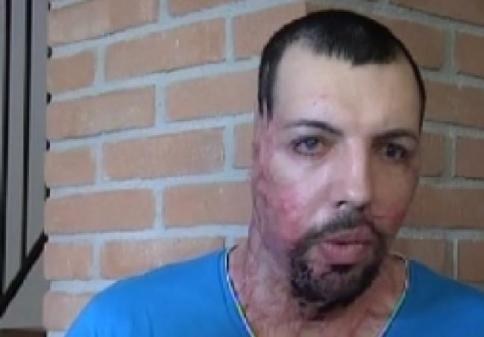 La madre dello sfregiato con l'acido dalla ex: "Ci ha chiamato la Annibali" La madre dello sfregiato con l'acido dalla ex: "Ci ha chiamato la Annibali"