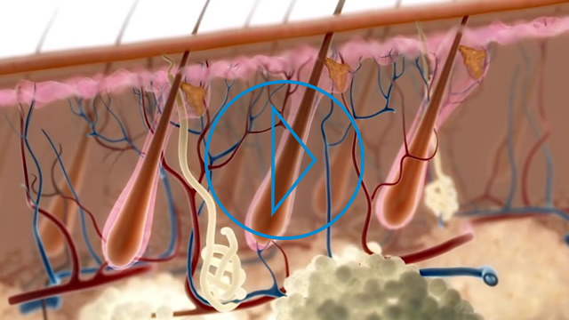 L'ultima cura contro l'alopecia è la Rigenerazione Cellulare L'ultima cura contro l'alopecia è la Rigenerazione Cellulare