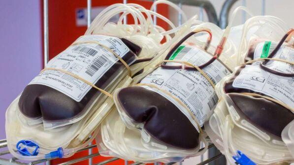 trasfusione di sangue giovane combatte alzheimer